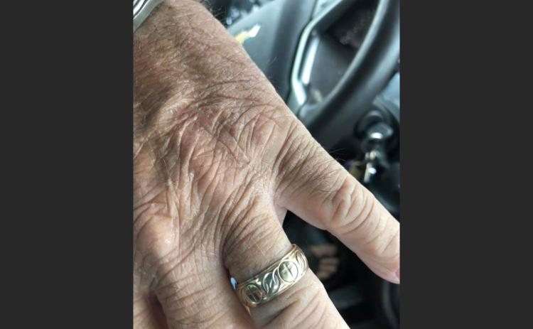 Tommy Smith models his recovered wedding band. (COURTESY)